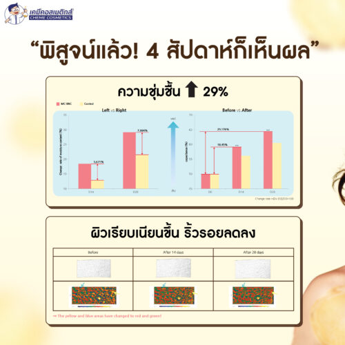 MC-BNC (H) สารสกัดโปรตีนหน้าเด็ก (Baby NMF Complex) อุดมด้วยกรดอะมิโนและแร่ธาตุ 39 ชนิดจากธรรมชาติ เพิ่มความชุ่มชื้น ลดเรือนริ้วรอย ช่วยให้ผิวดูอ่อนเยาว์และมีสุขภาพดีเหมือนผิวทารก - Image 5