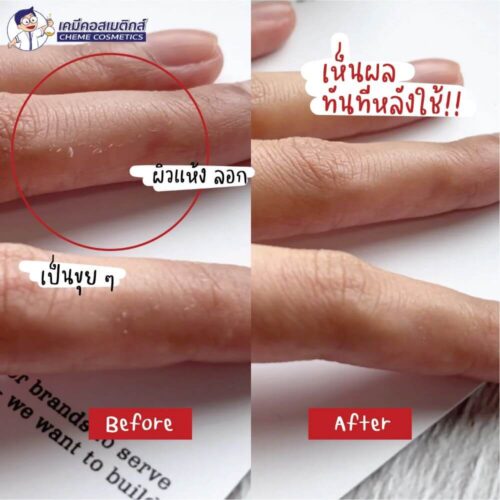 ชุดทดลอง Glysolid Beta Glucan Cream (สำหรับผิวแห้ง) CTL-210602-01JP - Image 3