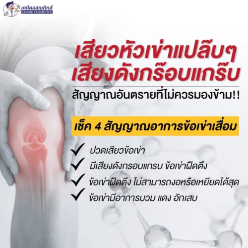 COLLA2GEN (Undenatured Collagen Type II) คอลลาเจน ชนิดที่ 2 เน้น บำรุงข้อต่อ ชะลอ และฟื้นฟู กระดูกอ่อน เอ็น ข้อบรรเทาและลดอาการอักเสบข้อเข่าเสื่อม สร้างและซ่อมแซมกระดูกช่วยให้มวลกระดูกเพิ่มขึ้น - Image 4