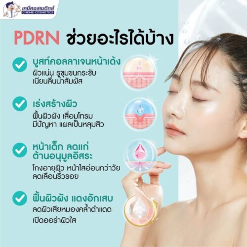 MC-PDRN (Polydeoxyribonucleotide 1%) สารสกัด DNA อสุจิปลาแซลมอน แบบน้ำ ฟีลเลอร์เติมเต็มริ้วรอยลึก ผิวเด้งใส อิ่มฟู ลดริ้วรอย - Image 4