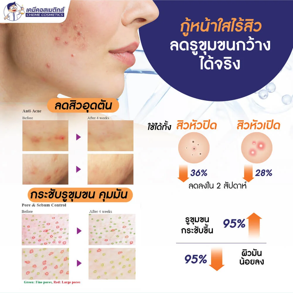 CG-PTX (Botulinum Toxin type C) โบทูลินั่มท็อกซินเปปไทด์ชนิดซี ตัวแรกของโลก นวัตกรรมลดเลือนริ้วรอย สิว ผิวอักเสบ และบรรเทาปวด แบบไร้เข็ม (Needle Free) - Image 6