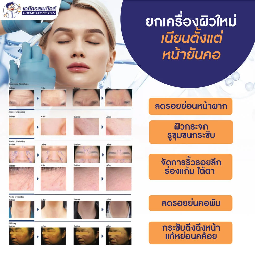 CG-PTX (Botulinum Toxin type C) โบทูลินั่มท็อกซินเปปไทด์ชนิดซี ตัวแรกของโลก นวัตกรรมลดเลือนริ้วรอย สิว ผิวอักเสบ และบรรเทาปวด แบบไร้เข็ม (Needle Free) - Image 5