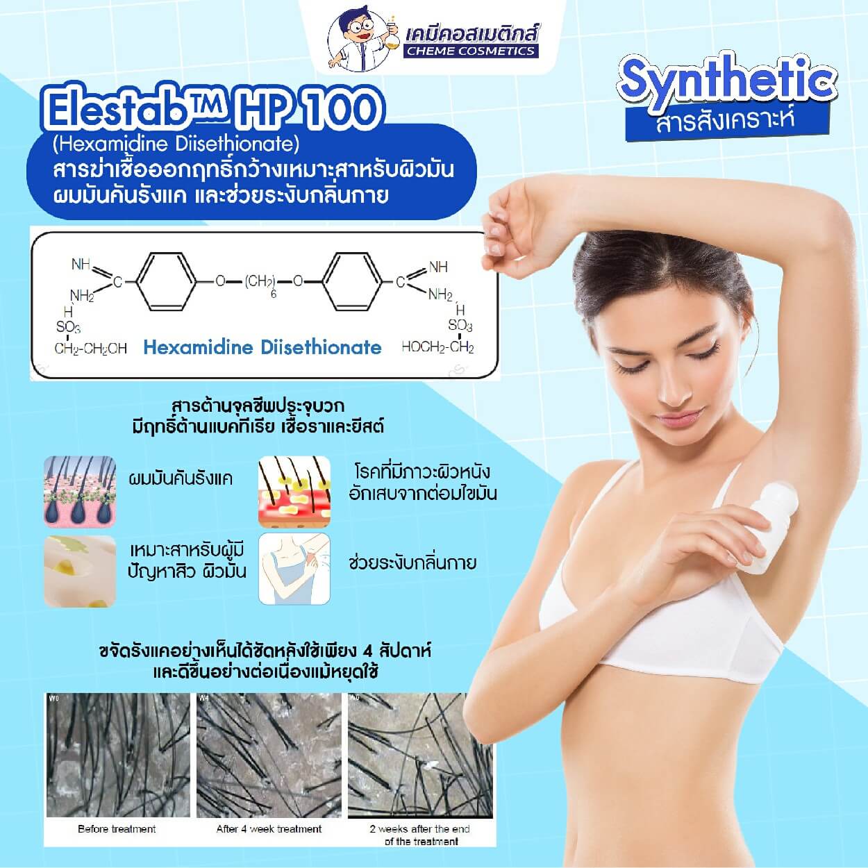 สาเหตุของปัญหากลิ่นไม่พึงประสงค์