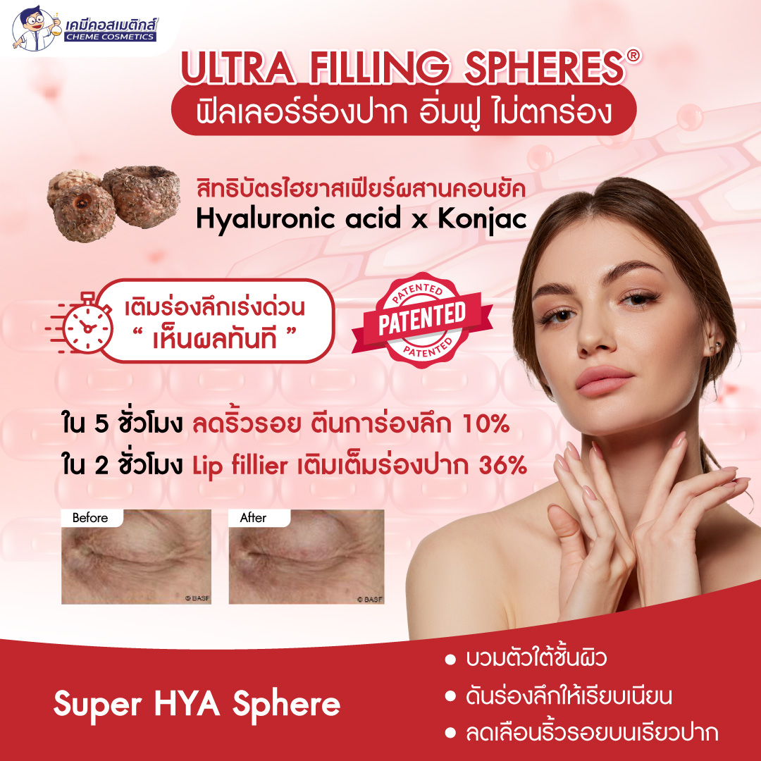 เทคโนโลยี Filling Sphere สำหรับเติมเต็มริ้วรอย