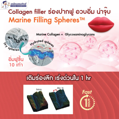 Alternative view of Marine Filling Spheres นวัตกรรมคอลลาเจนฟิลเลอร์ (Collagen Filler) เพิ่มความชุ่มชื้นเติมเต็มร่องลึกหน้าเงาใสผิวเรียบเนียน