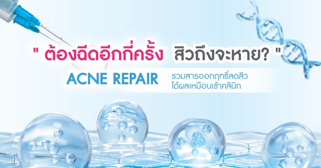 💥 สิวจะหาย ต้องฉีดอีกกี่ครั้ง? หรือแค่ใช้สารออกฤทธิ์ดีๆ ก็จบ!
