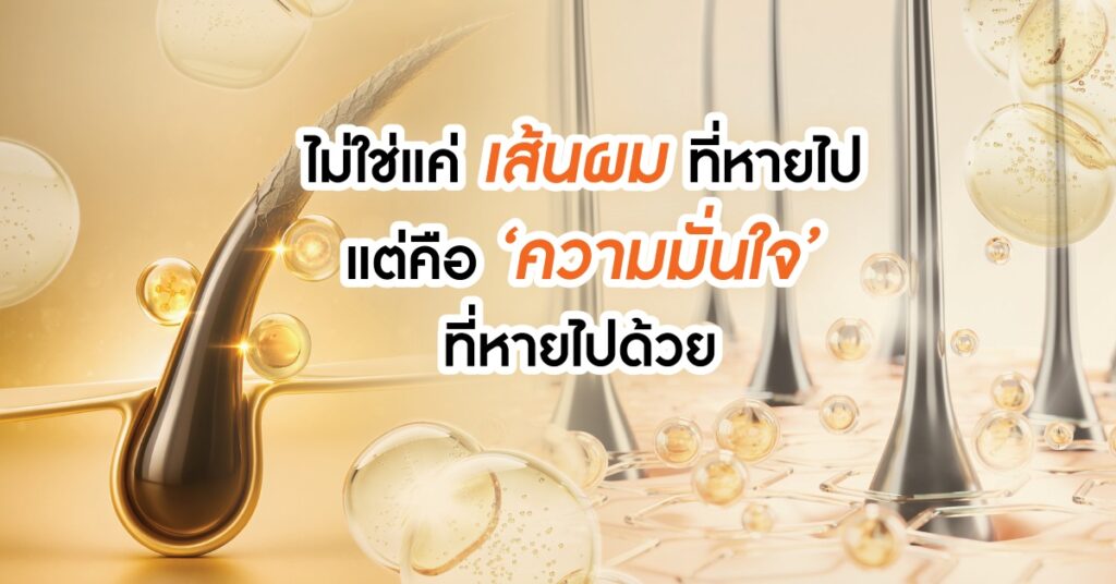 🌟 ปัญหาผมร่วง: เรื่องเล็กที่ผู้บริโภครู้สึกใหญ่
