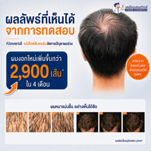 Aloversil BC10156 (Hippophae Rhamnoides Kernel Extract) สารสกัดเปปไทด์จากซีบัคธอร์น เพื่อกระตุ้นการงอกใหม่ของเส้นผม ปลุกรูขุมขนที่ซบเซา ชะลอผมร่วง เพิ่มความหนาแน่นของเส้นผม - Image 4