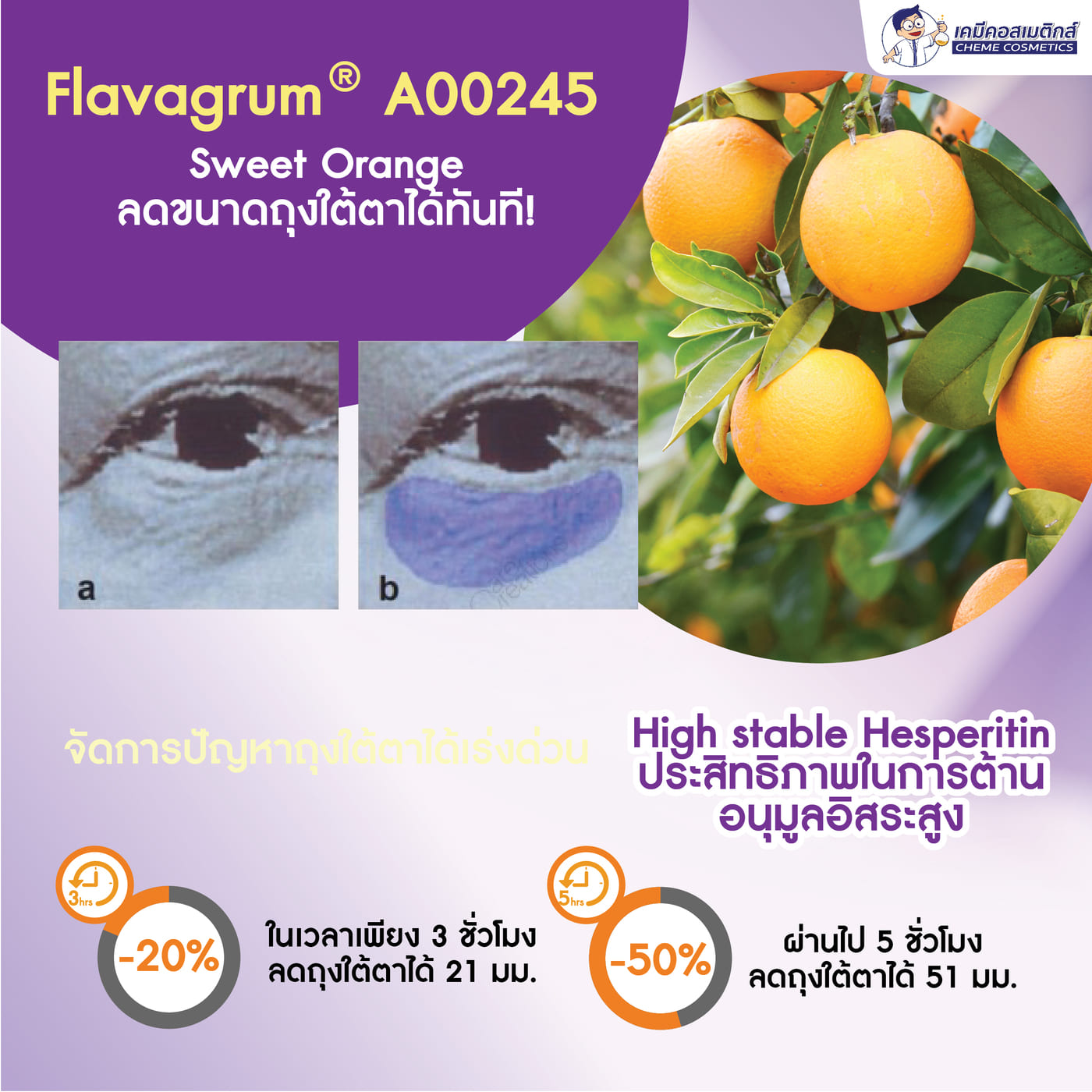 การดูแลปัญหาถุงใต้ตาและความหย่อนคล้อย