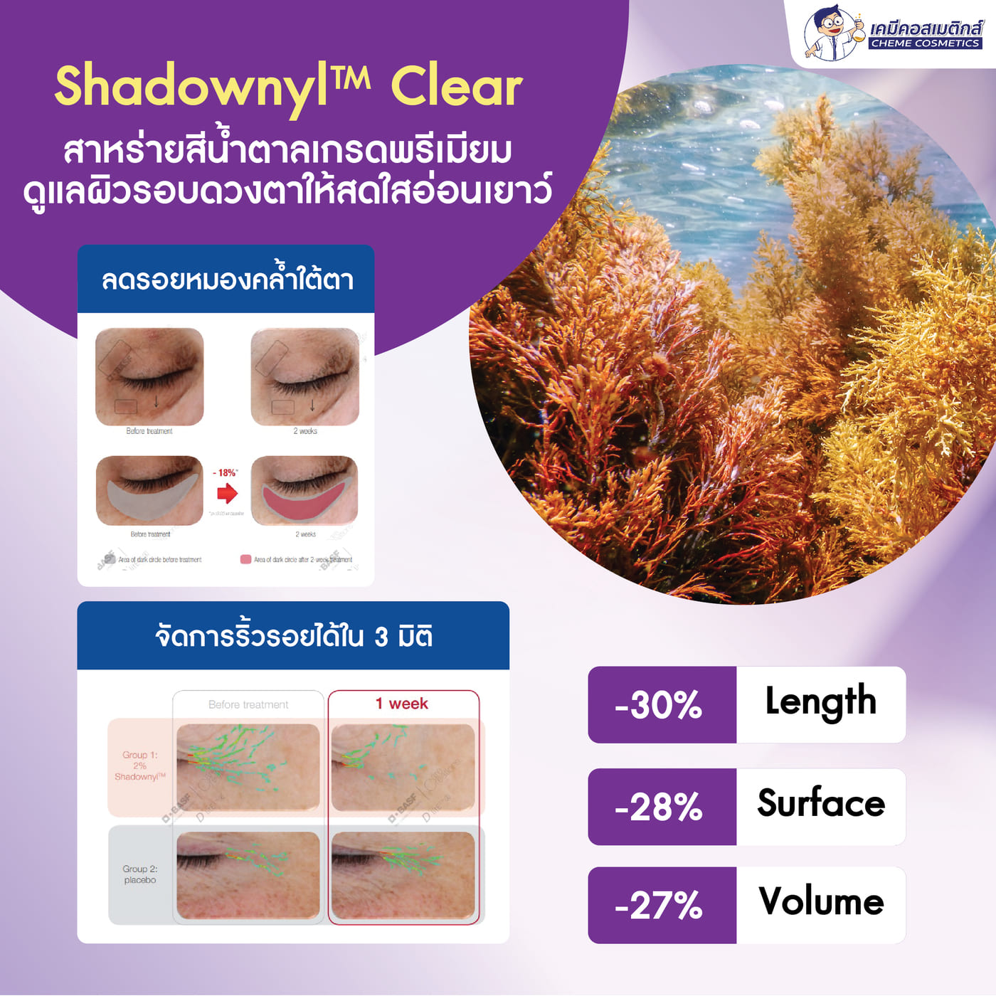คืนความสดใสและความอ่อนเยาว์ให้ผิวรอบดวงตา