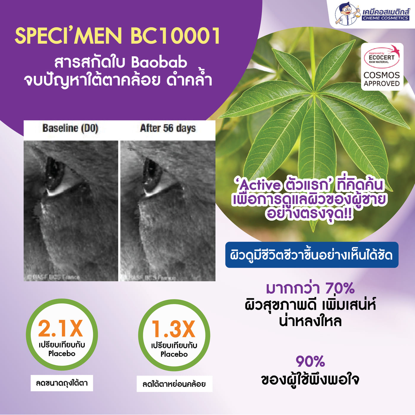 การดูแลผิวรอบดวงตาให้สดใสและดูอ่อนเยาว์